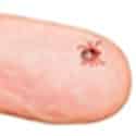 tick